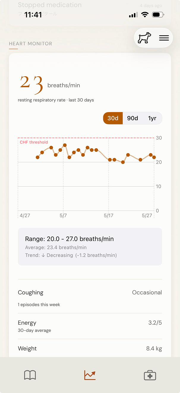 Bond Epilepsy condition monitor with days seizure-free and frequency comparison